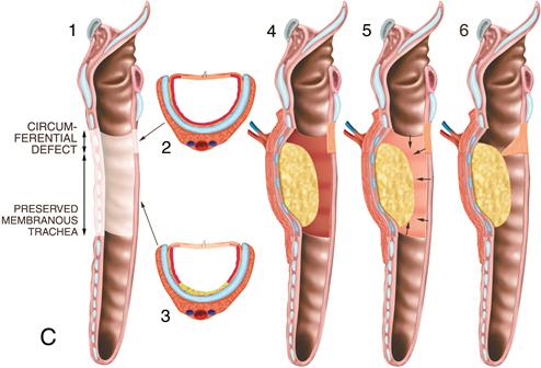 Trachea